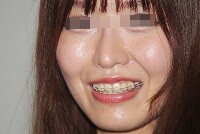 キャンギャルの顔面アップ051